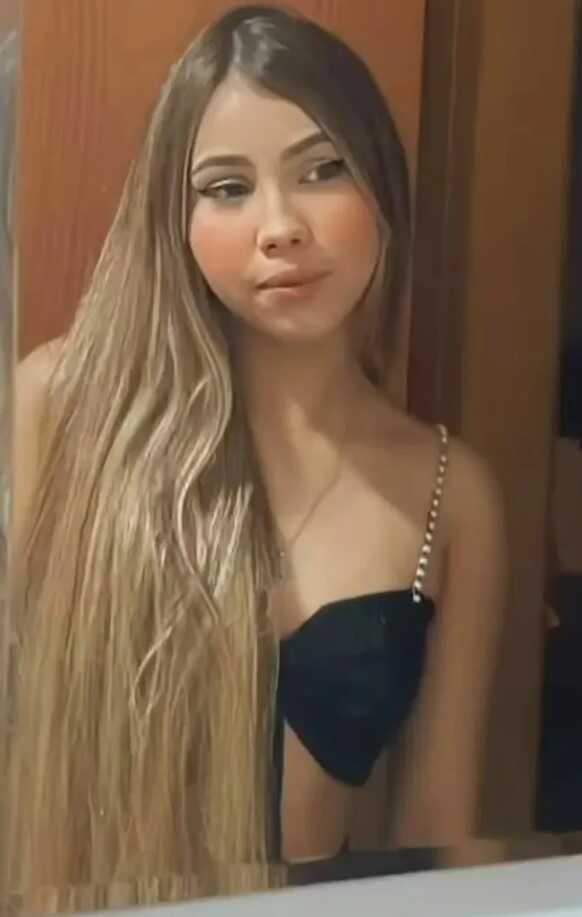 Karting yarışında aracın motoruna saçını kaptıran genç kızın kafa derisi koptu Karting yarışında aracın motoruna saçını kaptıran genç kızın kafa derisi koptu