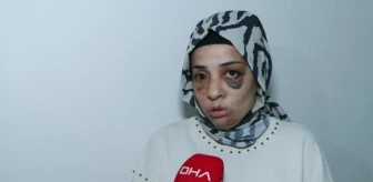 Bağcılar'da Şiddet Mağduru Kadın Devletten Yardım Bekliyor