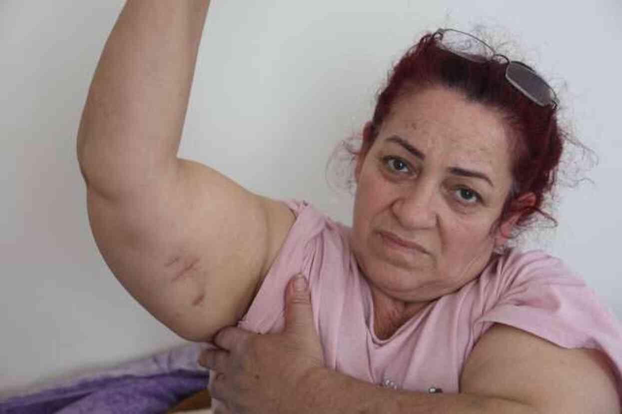 Köpeklerin saldırısına uğrayan kadın: Ben o an öldüğümü sandım