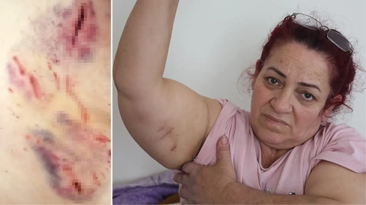 Başıboş köpekler işe giden kadının her yerini parçaladı! Feryatları sokağı inletti