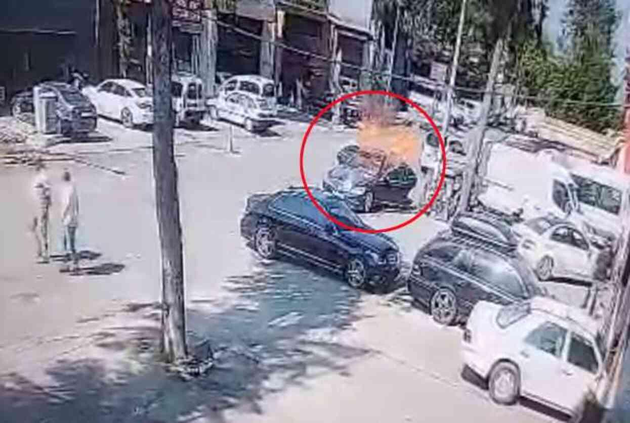 7 ayda 15 ameliyat geçirdi! Vücudunun yüzde 80'i yanan liseli Beyzanur'un son görüntüsü yürek burktu 7 ayda 15 ameliyat geçirdi! Vücudunun yüzde 80'i yanan liseli Beyzanur'un son görüntüsü yürek burktu