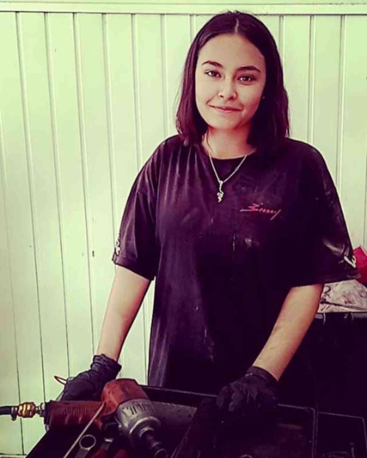 7 ayda 15 ameliyat geçirdi! Vücudunun yüzde 80'i yanan liseli Beyzanur'un son görüntüsü yürek burktu