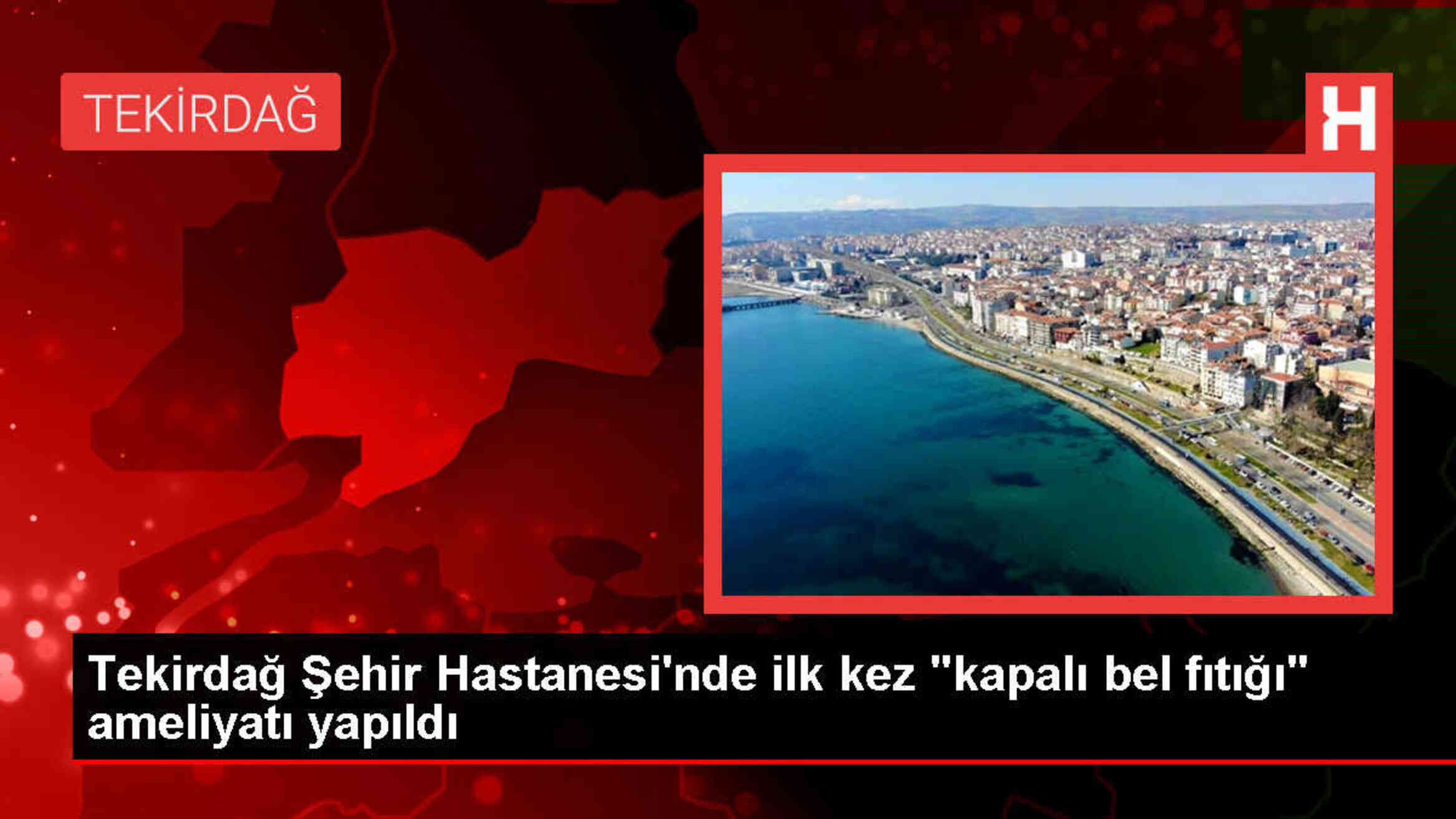 Tekirdağ Dr. İsmail Fehmi Cumalıoğlu Şehir Hastanesi'nde Kapalı Bel Fıtığı Ameliyatı Yapıldı