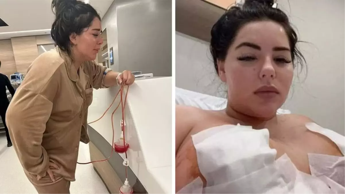 Meme dikleştirme operasyonu geçiren İngiliz model Chloe Rose'un göğüs uçları çürüdü