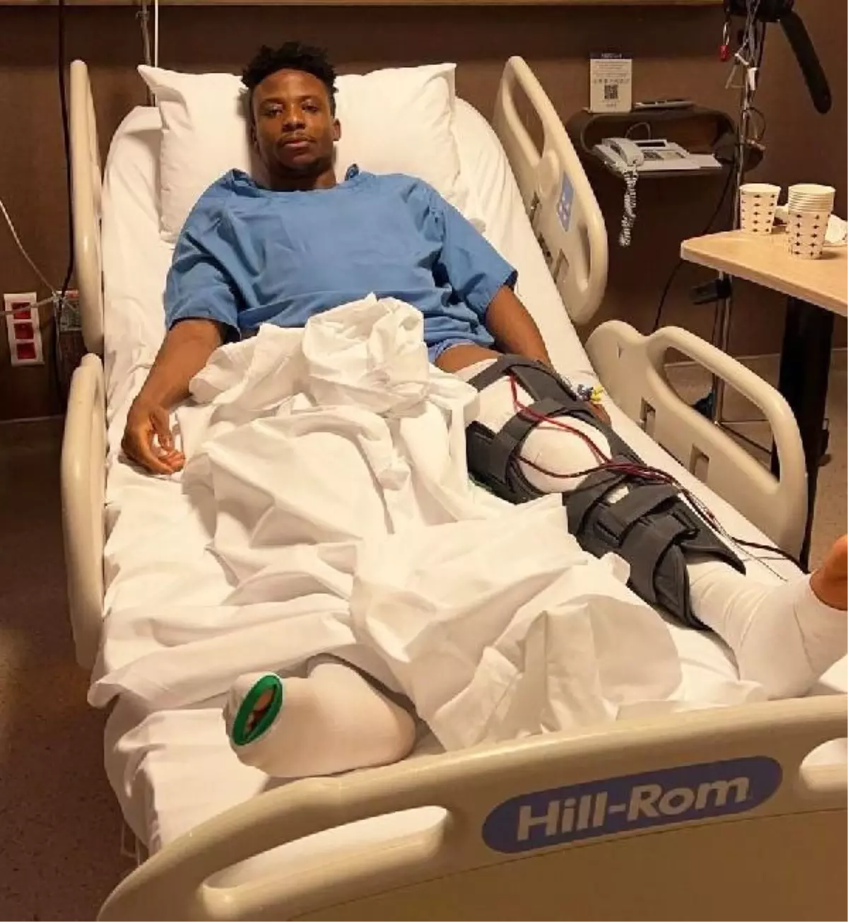 Kayserisporlu Anthony Uzodimma Sol Dizinden Ameliyat Oldu