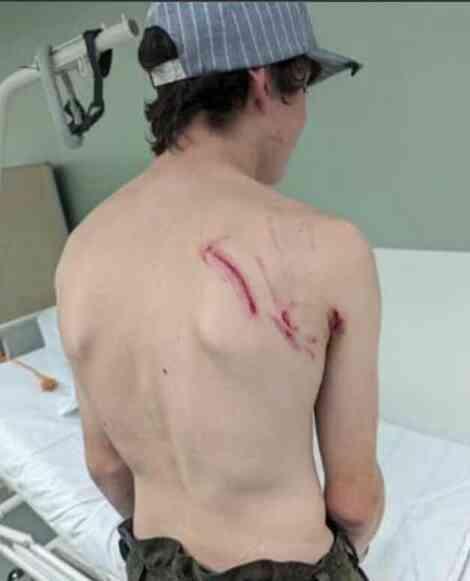 İsveçli adam, yüzünü parçalayan ayıyı kebap yaparak intikam aldı İsveçli adam, yüzünü parçalayan ayıyı kebap yaparak intikam aldı