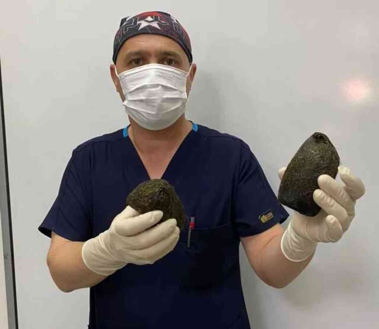 Hastanın midesinden 2 kilo saç kütlesi çıkarıldı Hastanın midesinden 2 kilo saç kütlesi çıkarıldı