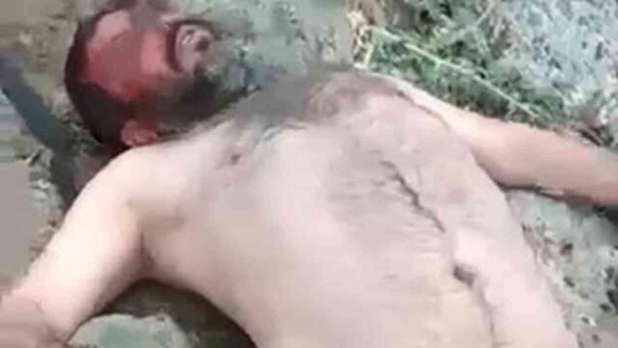 Önce işkence sonra teşhir! İki ay yoğun bakımda kalan çoban utancından evden çıkamıyor Önce işkence sonra teşhir! İki ay yoğun bakımda kalan çoban utancından evden çıkamıyor