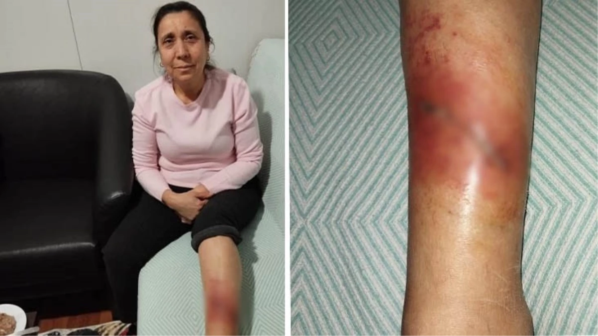 Sokak köpeklerinin saldırısına uğrayarak yaralanan kadın ayağa kalkamıyor