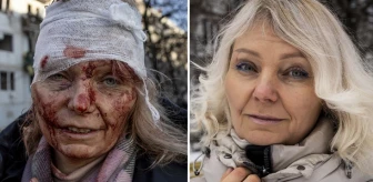 Fotoğrafıyla Rusya-Ukrayna Savaşı'nın simgesi olmuştu! Olena Kurilo 2 yıl sonra evine döndü