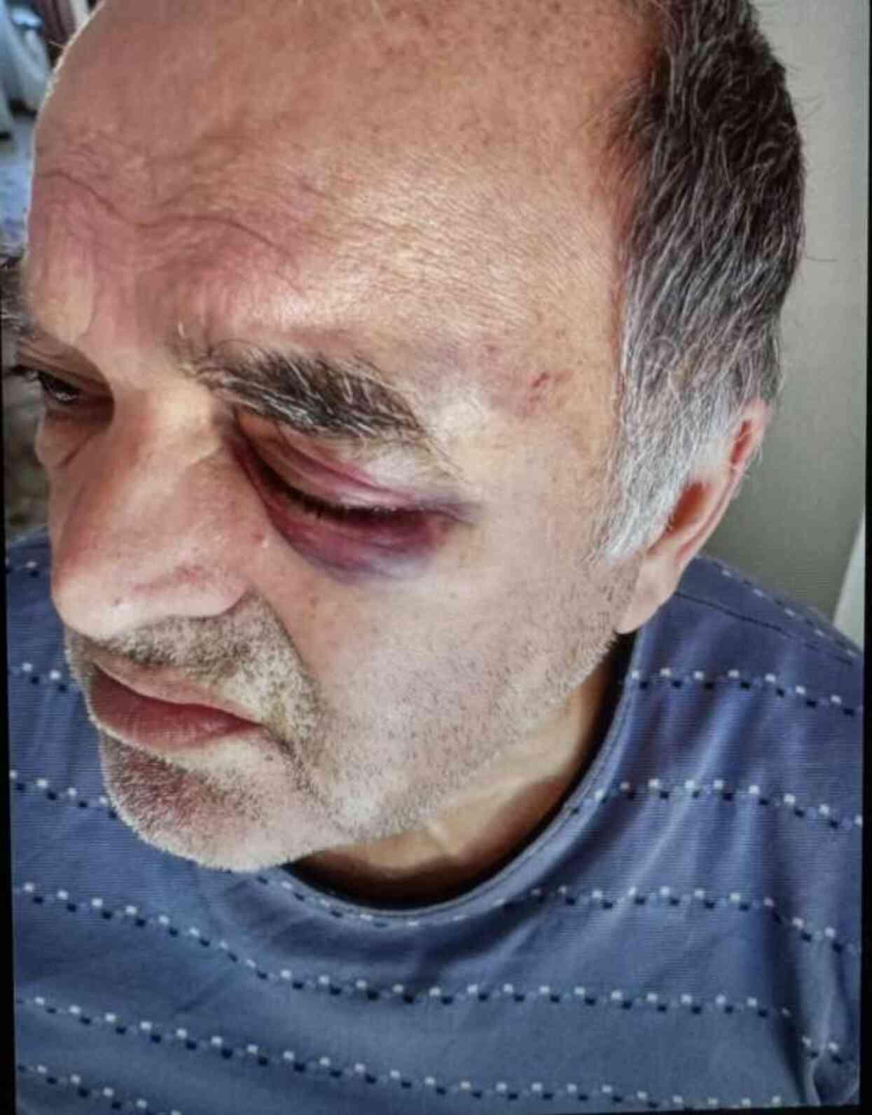 Okul Müdürünün Darp Ettiği Çift İHA'ya Konuştu Okul Müdürünün Darp Ettiği Çift İHA'ya Konuştu