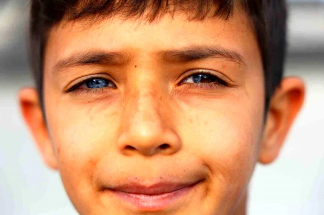 Adana'da doğuştan iki farklı renkte gözlere sahip çocuk hayrete düşürüyor