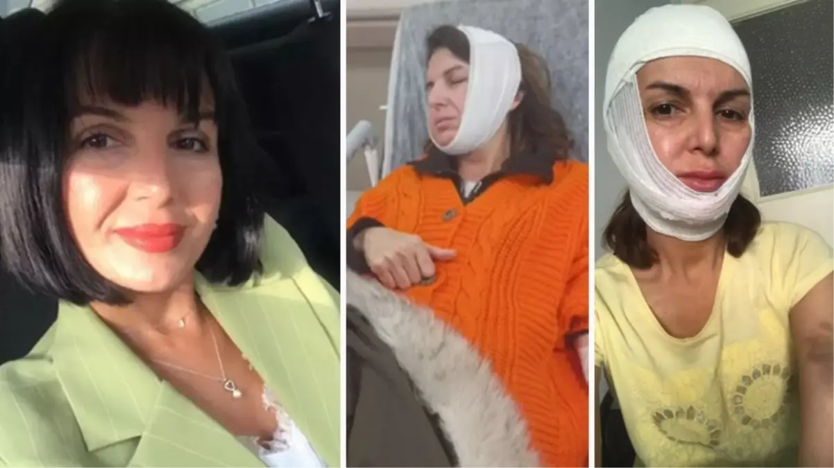 Güzellik merkezinde topuklu ayakkabı dayağı