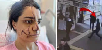 Uğradığı saldırıda yüzüne 40 dikiş atılan kadın güvenlik görevlisi dehşet anlarını anlattı: Beni işimden edersen öldürürüm