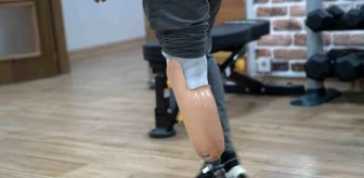 Kahramanmaraş Felaketinde Enkaz Altında Kaybettiği Bacağını Yeni Proteziyle Yürüyebiliyor