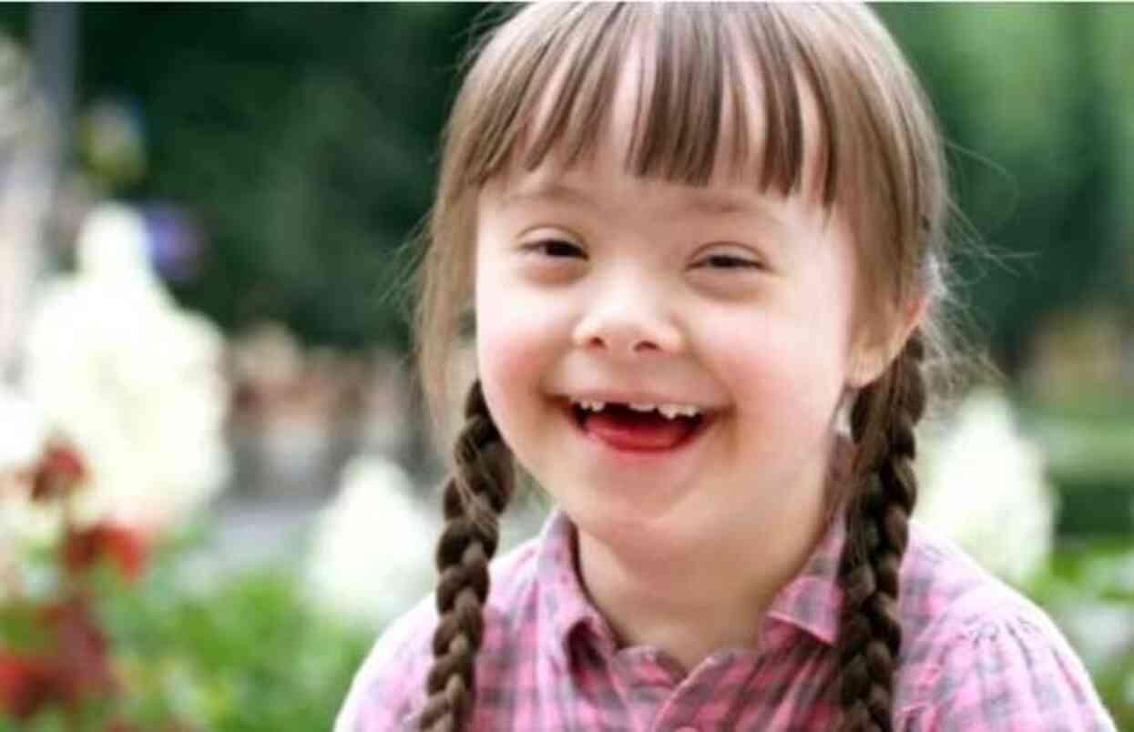 21 Mart down sendromu farkındalık günü mesajları! Down sendromu günü ile ilgili sözler neler? 21 Mart down sendromu farkındalık günü mesajları! Down sendromu günü ile ilgili sözler neler?