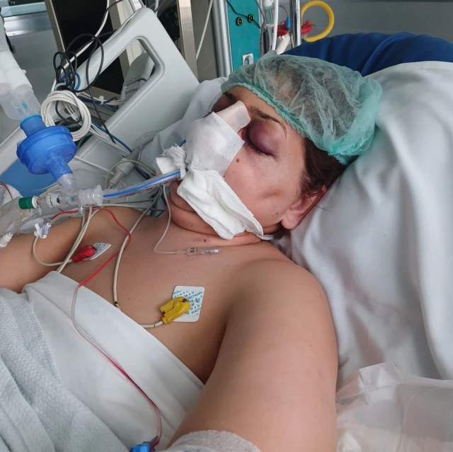 3 çocuk annesi, estetik ameliyatından 5 gün sonra hayatını kaybetti