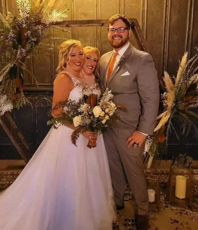 3 yıl önce evlenmişlerdi! Yapışık ikizlerin düğününden kareler ortaya çıktı
