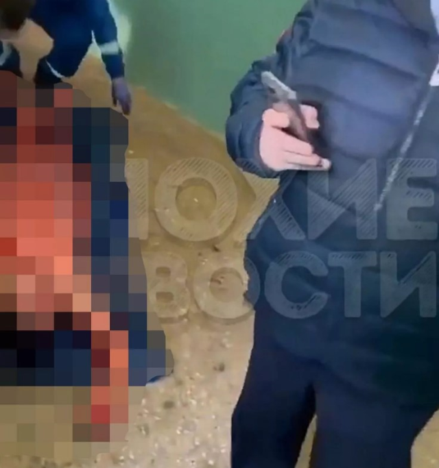 Rusya'da kıskançlık krizine giren kadın, kocasının penisini bıçakla keserek parçalara ayırdı
