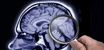 İngiltere Alzheimer hastalığını erken teşhis etmek için kan testleri yapıyor