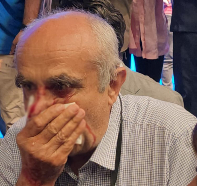 Mazbata töreninde kavga! MHP'li isim, zafer işareti yapan CHP'li Meclis Üyesi'ne kafa atıp burnunu kırdı