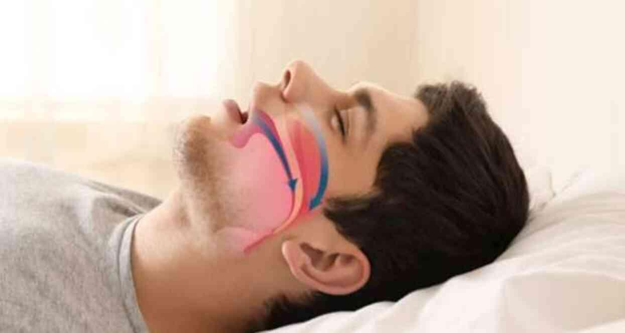 UYKU APNESİNE HANGİ BÖLÜM BAKIYOR? Uyku apnesi nedir, belirtileri neler?