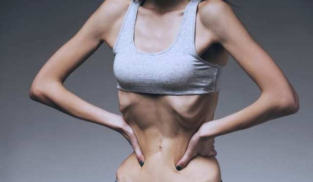 ANOREKSİYA NEDİR? Nihal Candan'ın hastalığı anoreksiya ne, belirtileri neler?