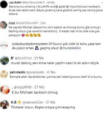 Murat Dalkılıç'ın son hali! Murat Dalkılıç'ın burnuna ne oldu?