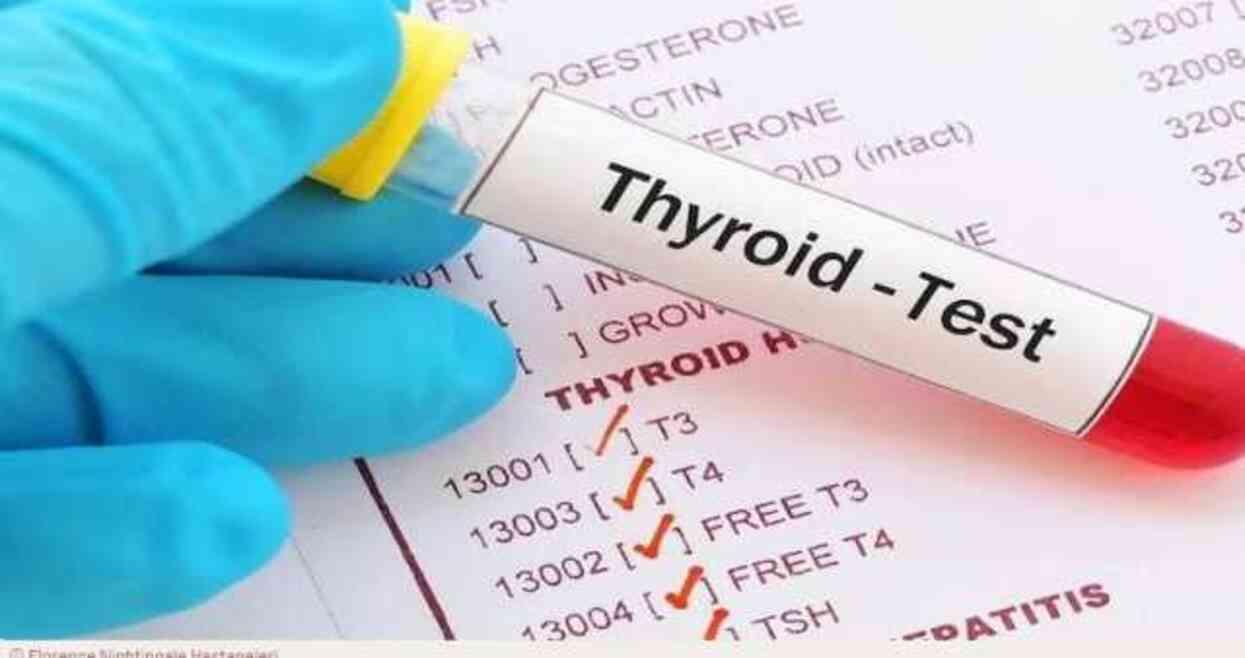 TSH yüksekliği nedir? TSH değeri yüksek çıkarsa ne olur?