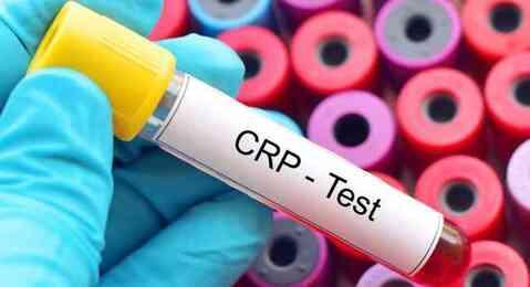 CRP NEDEN YÜKSELİR? CRP nedir, normal değeri kaç? CRP NEDEN YÜKSELİR? CRP nedir, normal değeri kaç?