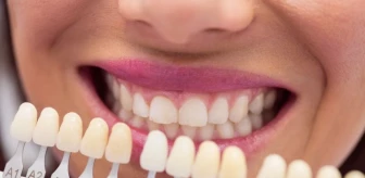 Dişler en hızlı nasıl beyazlar? Dişleri anında bembeyaz eden yöntemler