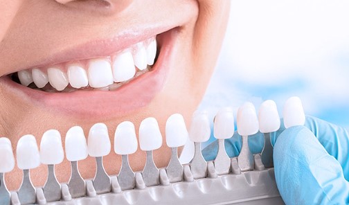 Dişler en hızlı nasıl beyazlar? Dişleri anında bembeyaz eden yöntemler