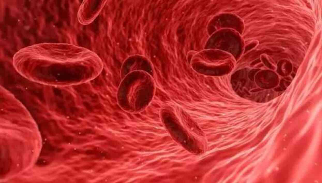 Talasemi nedir? Talasemi hastalığı tedavisi nedir?