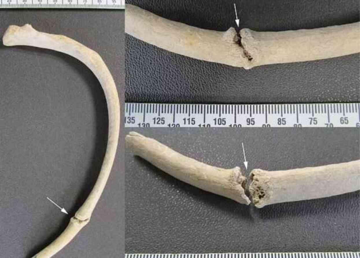 Arkeologlar, Dorset'in Demir Çağı'na ait 2000 yıl önce kurban olarak öldürülen genç bir kadının kalıntılarını buldu