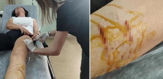 Sabah sporunda kabusu yaşadı! Talihsiz kadın başıboş köpeklerin saldırısında yaralandı