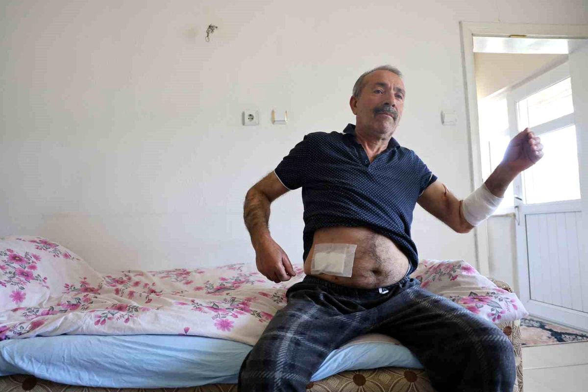 Nevşehir'de Sokak Köpeklerinin Saldırısına Uğrayan Adam Yaralandı