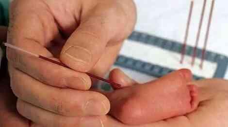 Bebeklerde fenilketonüri nedir? Fenilketonürili çocuklar nasıl beslenmeli? Bebeklerde fenilketonüri nedir? Fenilketonürili çocuklar nasıl beslenmeli?