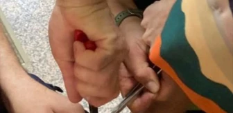 Zonguldak'ta İtfaiye Ekipleri Kadının Parmağına Sıkışan Yüzüğü Keserek Çıkardı