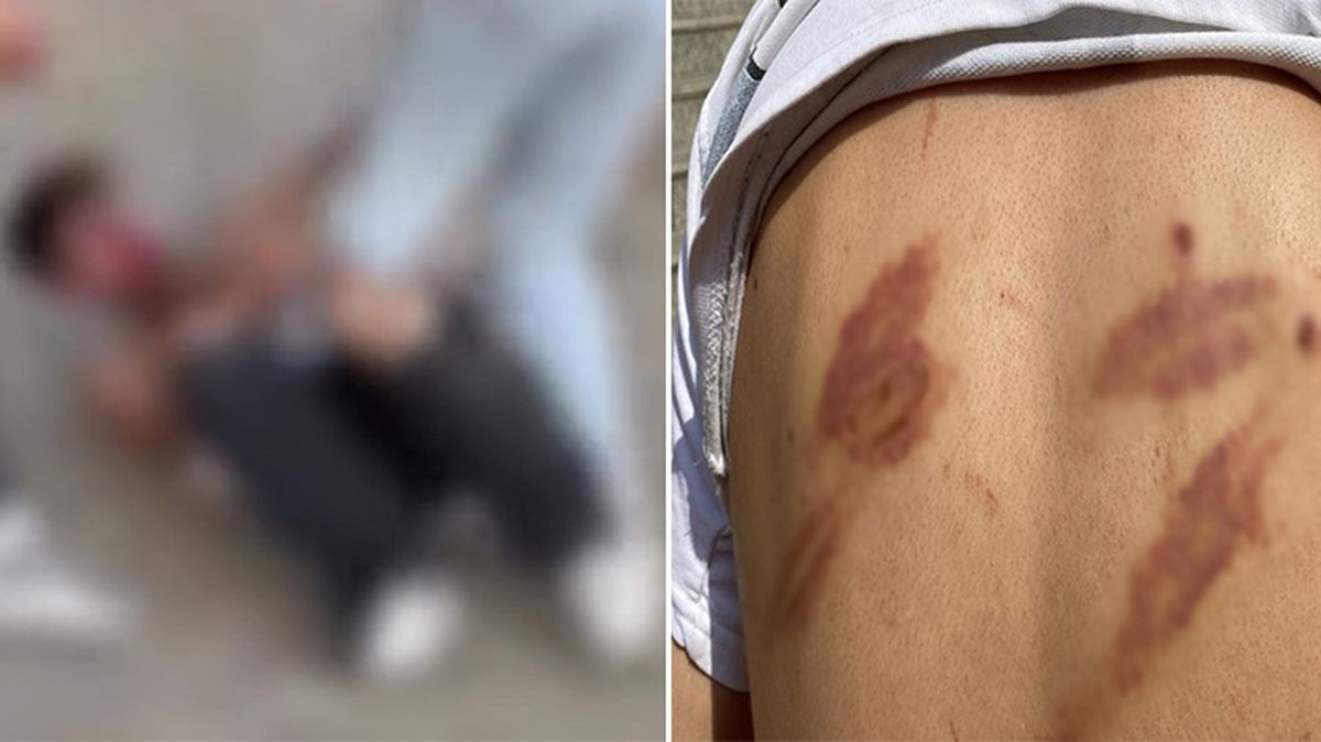 'Karısını dövüyor' diye öldüresiye dayak yemişti: Şiddet uygulamadı, kimseye kocamı dövün demedim