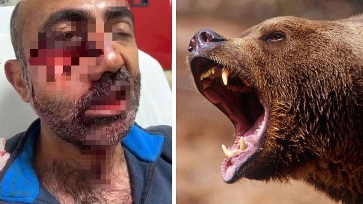 Tarlasına giden adam ölümden döndü! Ayı saldırısında suratı parçalandı, çene kemiği kırıldı