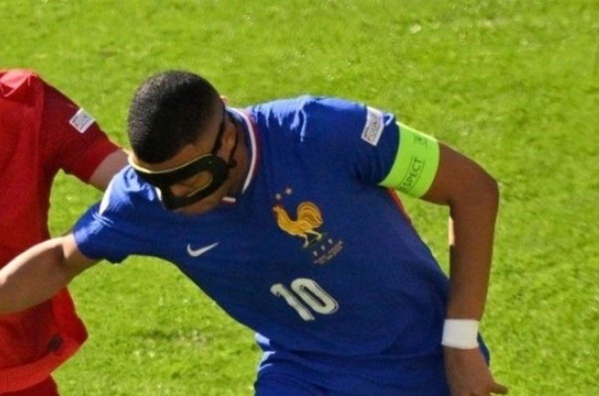 Mbappe neden maske takıyor? Mbappe sakat mı EURO 2024?