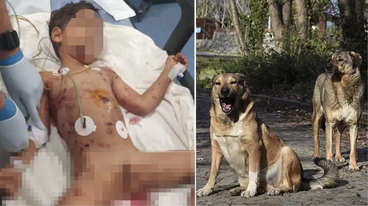 Sokak köpekleri 5 yaşındaki Abbas'ı hedef aldı! Ağır yaralanan çocuk yaşam savaşı veriyor