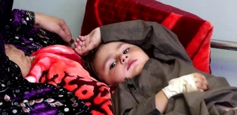 Afganistan'da Kızamık Nedeniyle Ölümler Artıyor