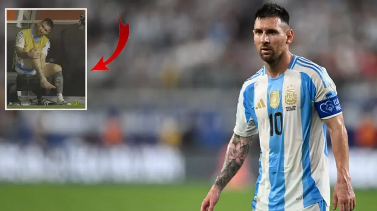 Maça devam edemedi! İşte Copa America finalinde sakatlanan Messi'nin ayağının son hali