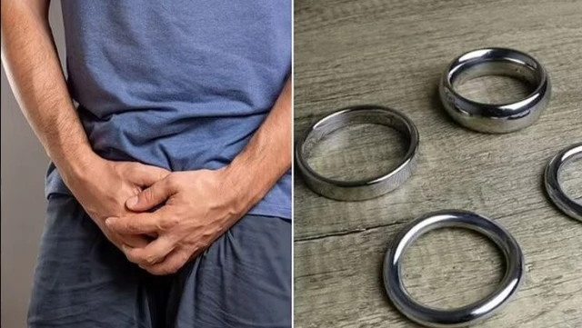 The sexual performance ring caused gangrene, and a part of the elderly man's penis was cut off.