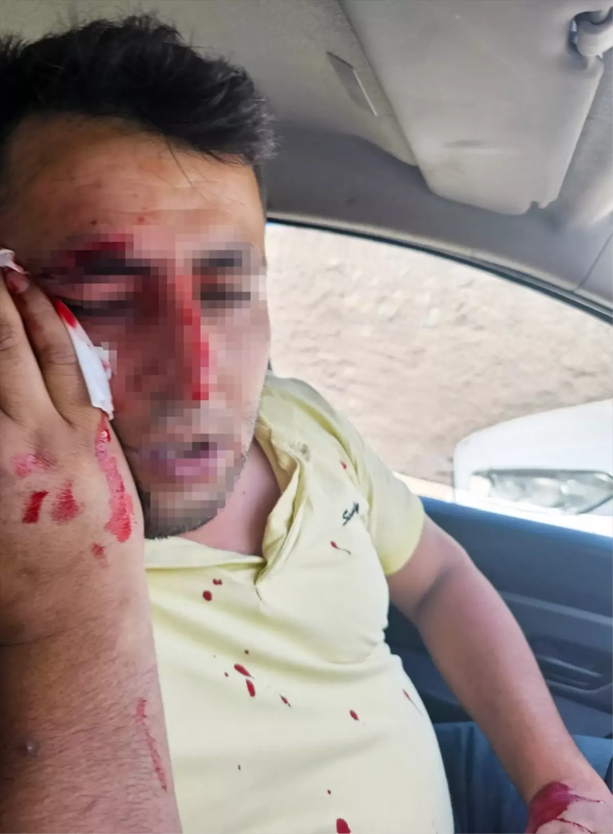 Dicle Elektrik Çalışanı Darbedildi, 2 Zanlı Tutuklandı