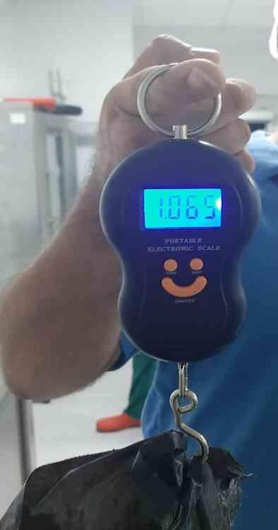 Ağrı şikayetiyle gitti, mesanesinden 1 kilogramlık taş çıkarıldı