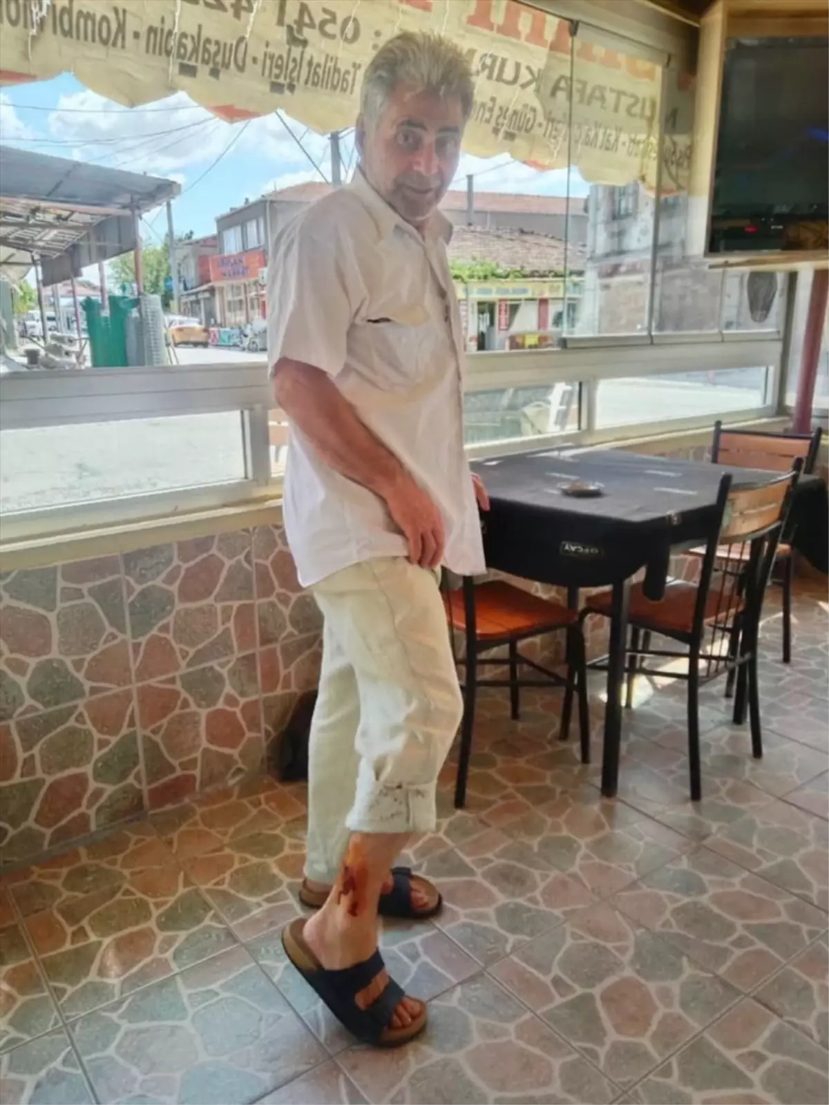 Çanakkale'de sahipsiz köpeklerin saldırısında yaralanan kişi tedaviye alındı