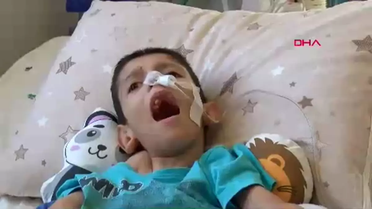 Hidrosefali Hastası Osmancan İlimsever, Hayata Burnundan Beslenerek Tutunuyor