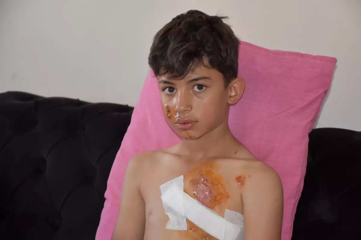 Sivas'ta Bisiklet Kazası: Çocuk İnşaat Demirine Saplandı